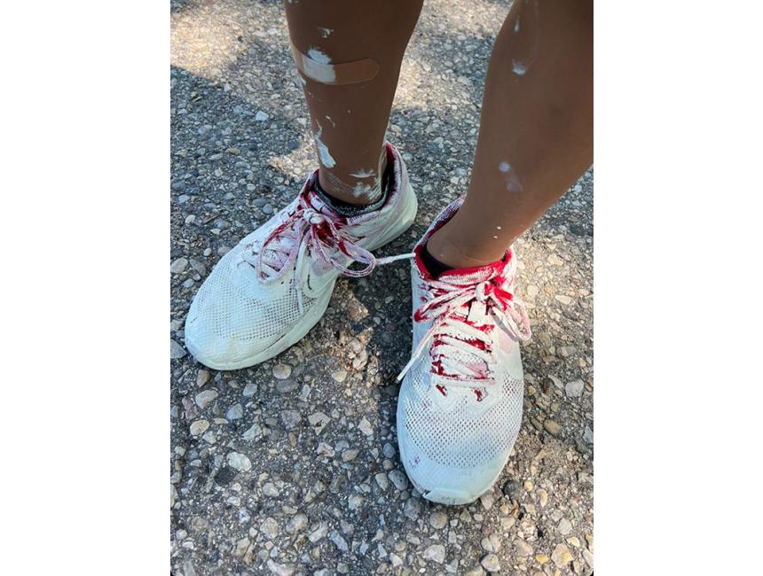 Paint-Covered Shoes